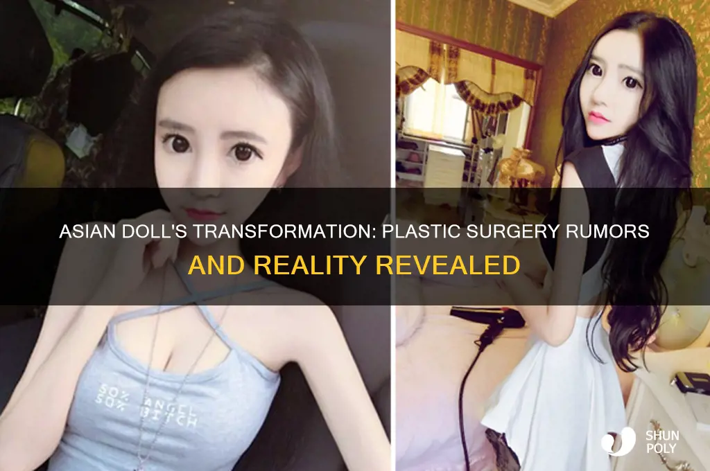 did asian doll get plastic surgery