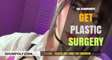 Asianbunnyx Plastic Surgery Speculations: Fact-Checking the Transformation Rumors