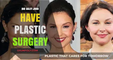 Ashley Judd's Appearance: Plastic Surgery Rumors and the Truth