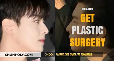 Astro's Transformation: Unveiling the Truth About Plastic Surgery Rumors