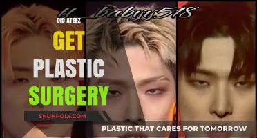 Did ATEEZ Undergo Plastic Surgery? Unveiling the Truth Behind the Rumors