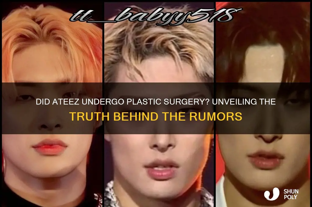 did ateez get plastic surgery