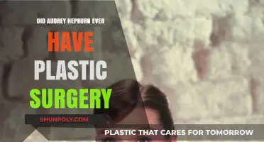 Audrey Hepburn's Timeless Beauty: Plastic Surgery Rumors Debunked