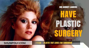Audrey Landers Plastic Surgery: Fact-Checking the Rumors and Speculations