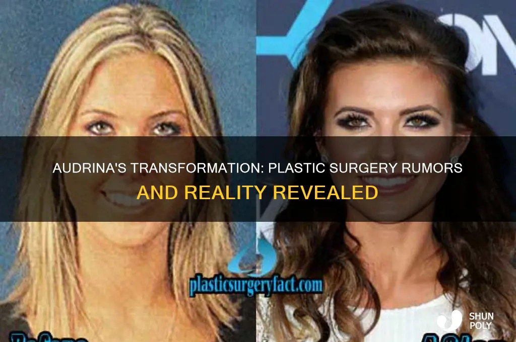 did audrina get plastic surgery