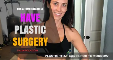 Autumn Calabrese Plastic Surgery: Fact-Checking the Rumors and Speculations