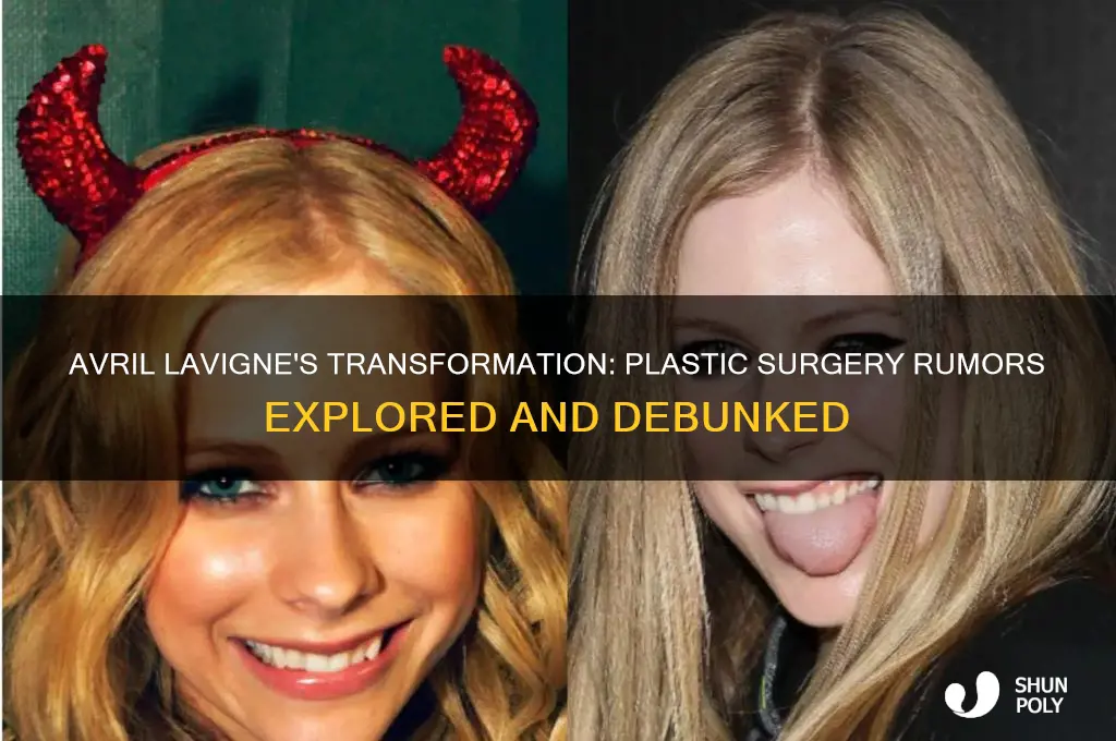 did avril lavigne get plastic surgery
