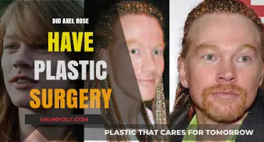 Did Axl Rose Undergo Plastic Surgery? Unveiling the Truth