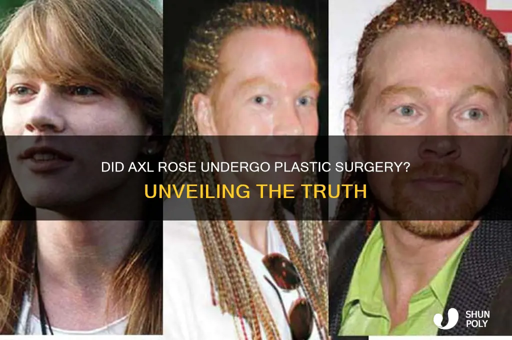 did axel rose have plastic surgery