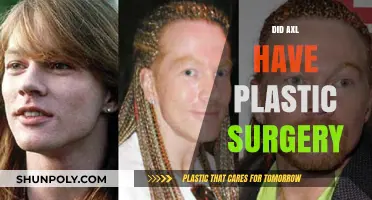 Axl Rose's Transformation: Plastic Surgery Rumors Explored and Debated
