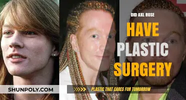 Axl Rose's Transformation: Plastic Surgery Rumors Explored