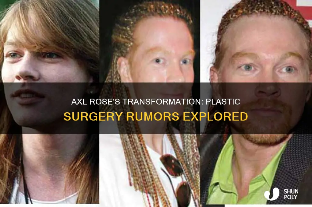 did axl rose have plastic surgery