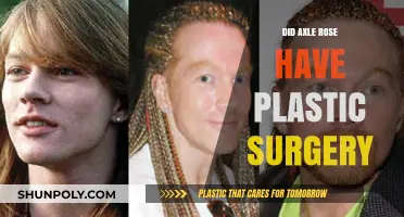 Axle Rose Plastic Surgery: Fact or Fiction? Uncovering the Truth