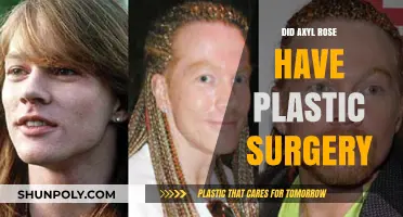 Axyl Rose Plastic Surgery: Fact or Fiction? Unveiling the Truth