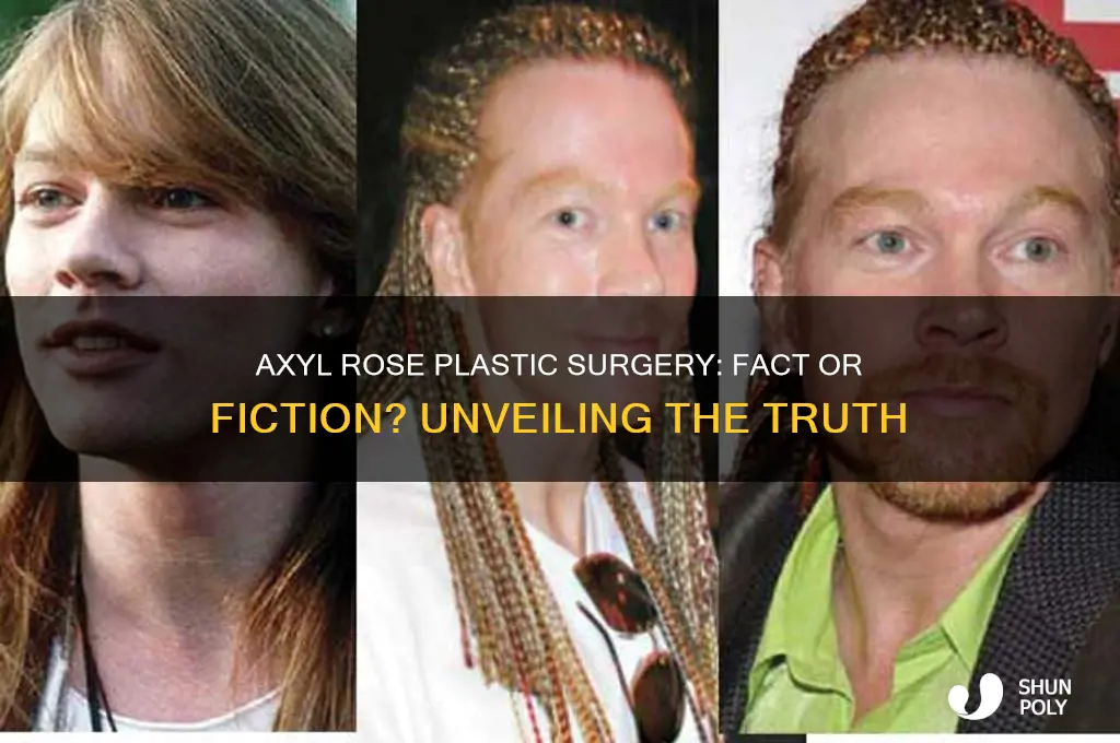 did axyl rose have plastic surgery