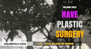 Babe Paley's Beauty Secrets: Plastic Surgery Speculations Explored