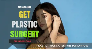 Did Baby Ariel Undergo Plastic Surgery? Unveiling the Truth