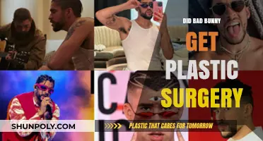 Bad Bunny's Transformation: Plastic Surgery Rumors and Speculations Explored