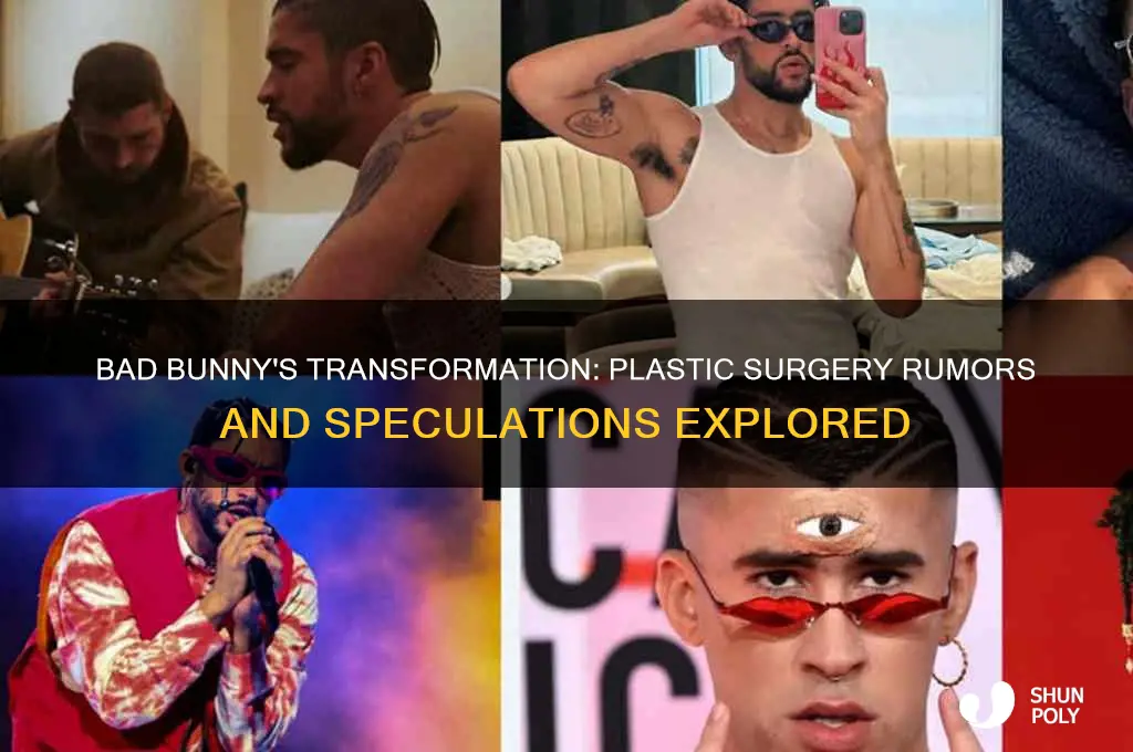 did bad bunny get plastic surgery