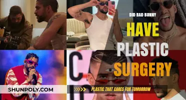 Bad Bunny's Transformation: Plastic Surgery Rumors Explored and Debunked