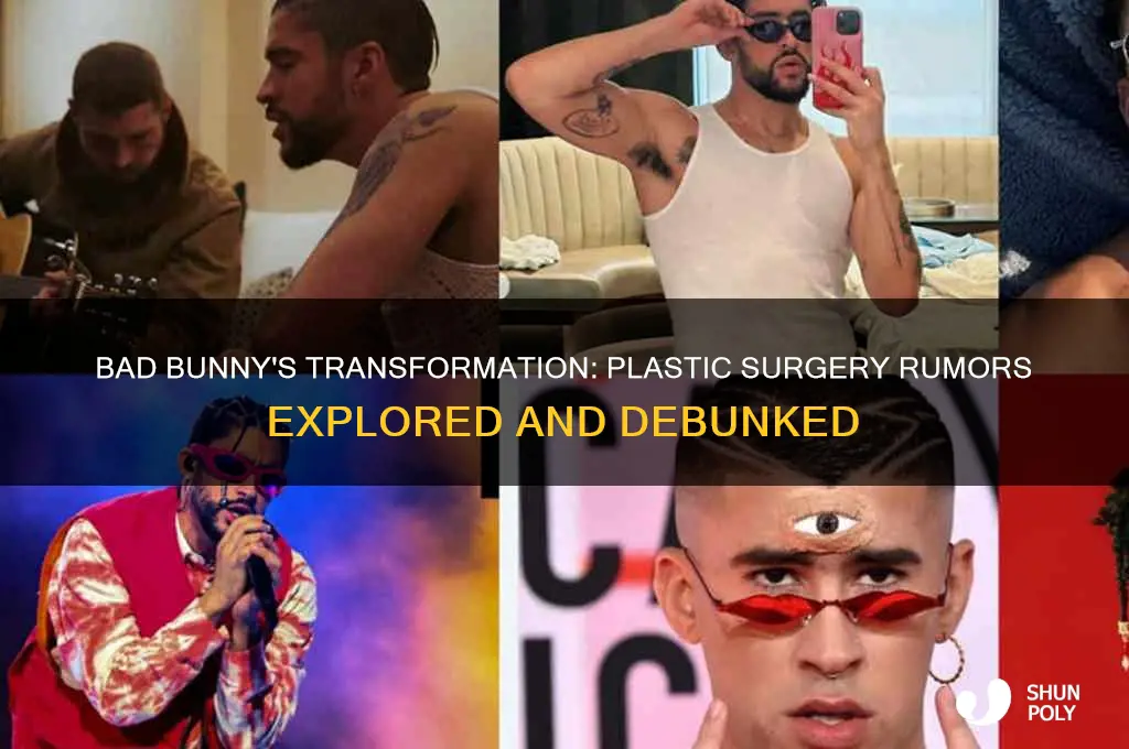 did bad bunny have plastic surgery
