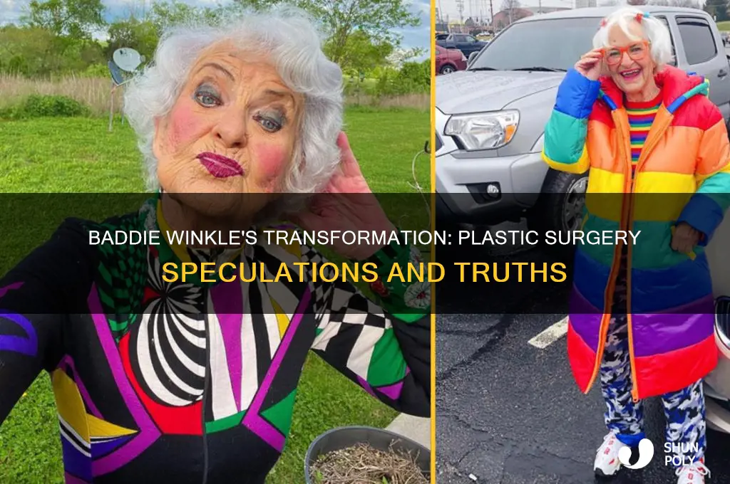 did baddie winkle get plastic surgery