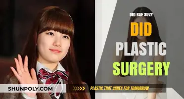Bae Suzy's Transformation: Plastic Surgery Rumors Explored and Debated