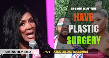 Bambi Scrapy's Wife: Plastic Surgery Speculations and Truths Revealed