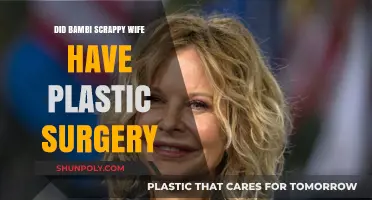 Bambi's Scrappy Wife: Plastic Surgery Speculations and Transformation