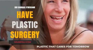 Barbra Streisand's Transformation: Plastic Surgery Speculations and Truths
