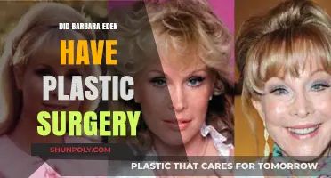 Barbara Eden's Ageless Beauty: Plastic Surgery Speculations Explored