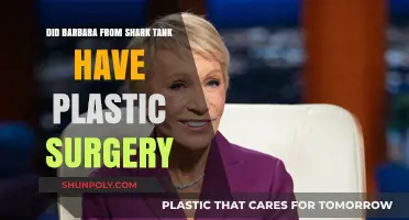 Barbara Corcoran's Transformation: Plastic Surgery Rumors on Shark Tank