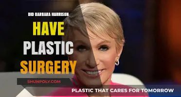 Barbara Harrison's Transformation: Plastic Surgery Speculations and Truths