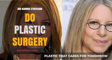 Barbra Streisand's Transformation: Plastic Surgery Rumors Explored
