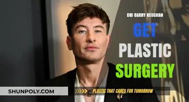Barry Keoghan Plastic Surgery: Fact-Checking the Transformation Rumors