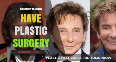 Barry Manilow's Transformation: Plastic Surgery Speculations and Truths