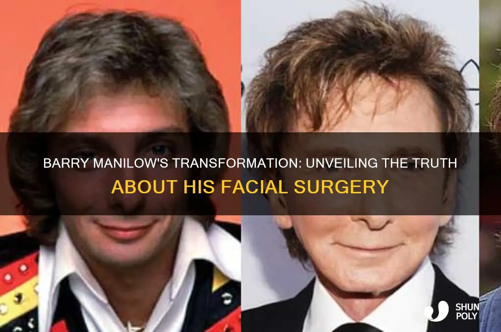 did barry manilow have plastic surgery on his face