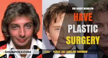 Barry Manilow's Transformation: Plastic Surgery Rumors Explored