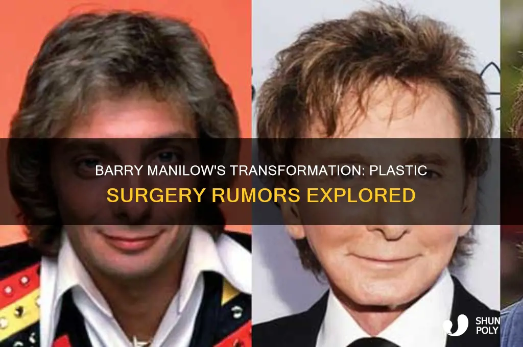 did barry manilow have plastic surgery