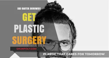 Bartek Borowiec's Transformation: Plastic Surgery Rumors Explored