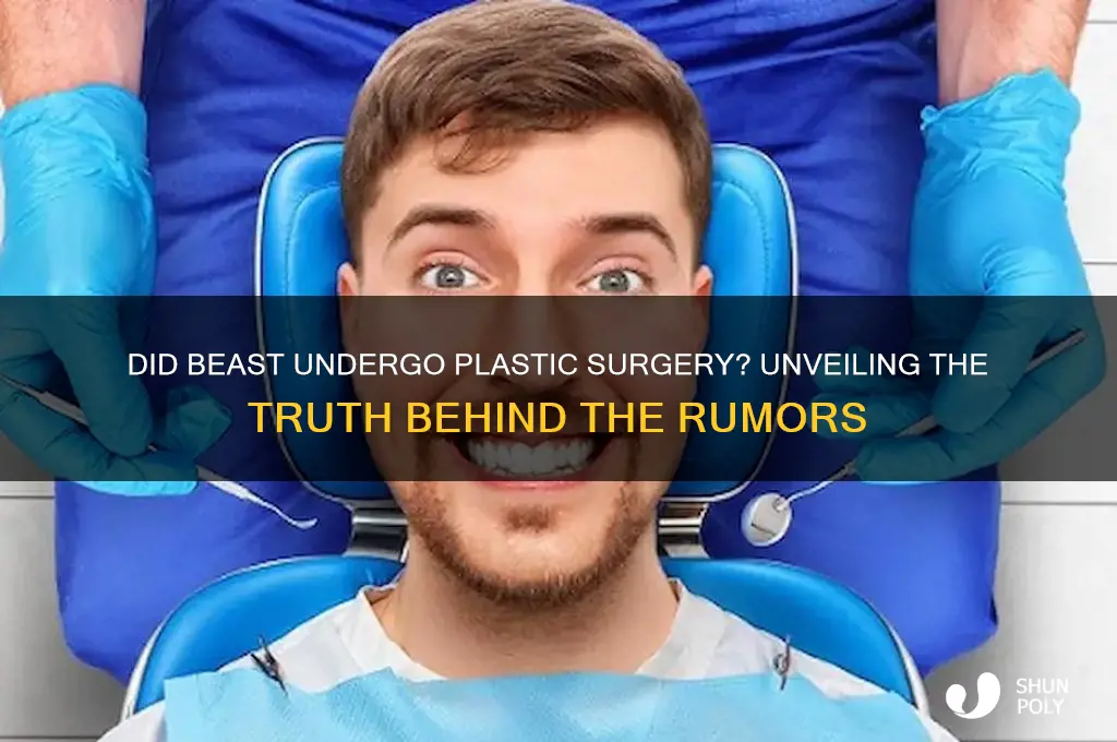 did beast get plastic surgery