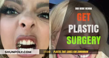 Bebe Rexha's Transformation: Plastic Surgery Rumors Explored and Debunked