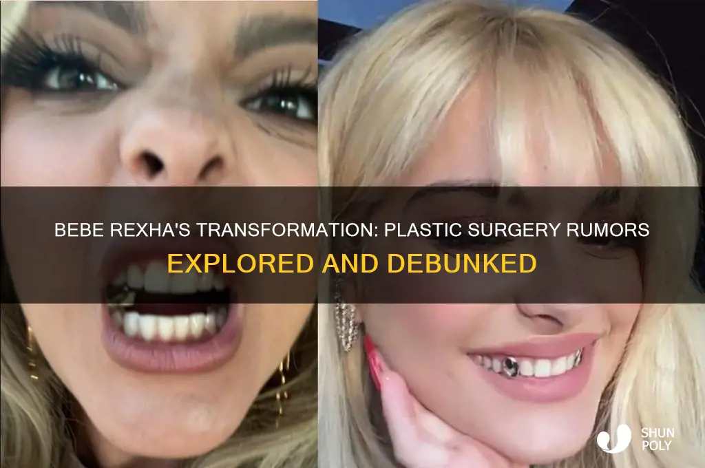 did bebe rexha get plastic surgery