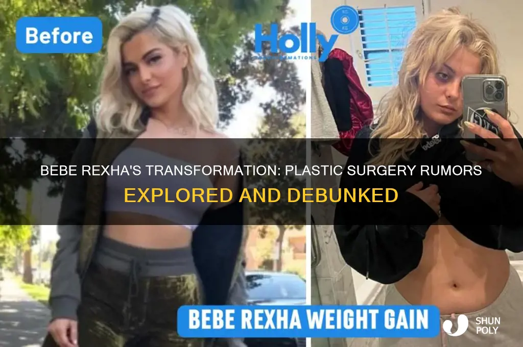 did bebe rexha get plastic surgey