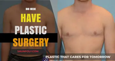 Did Beck Undergo Plastic Surgery? Unveiling the Truth Behind the Rumors