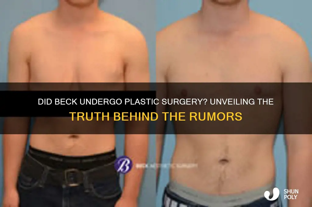 did beck have plastic surgery