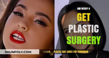 Becky G's Transformation: Plastic Surgery Rumors and Speculations Explored