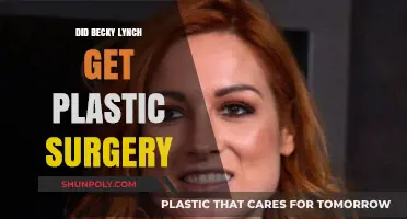 Becky Lynch Plastic Surgery: Fact-Checking the WWE Star's Transformation