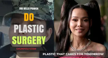Bella Poarch Plastic Surgery: Fact-Checking the Transformation Rumors