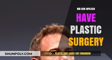 Ben Affleck's Transformation: Plastic Surgery Rumors and Reality Revealed